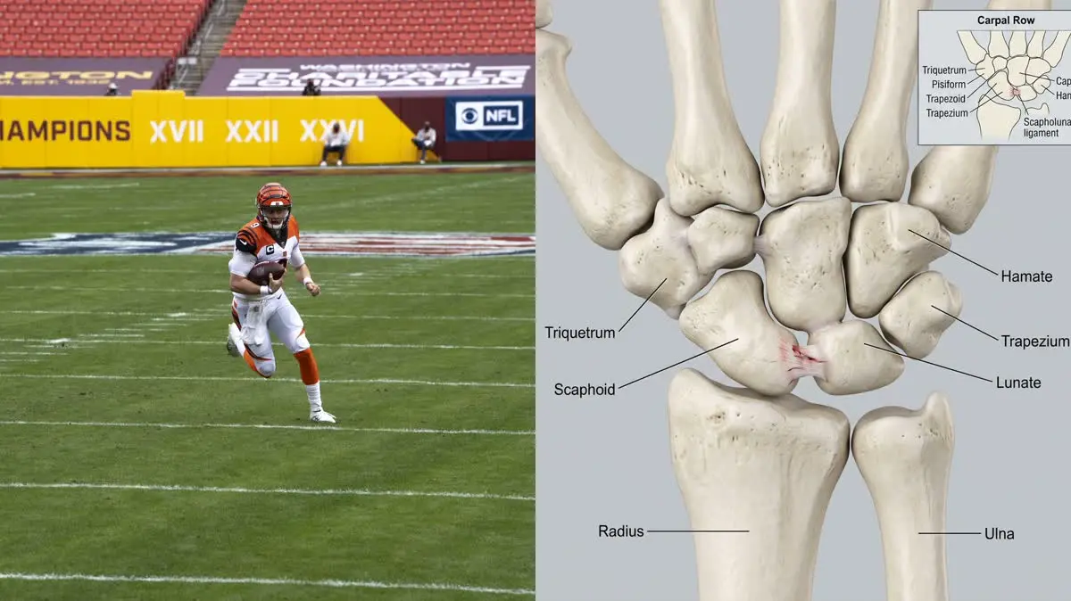 Joe Burrow's Scapholunate Ligament Wrist Tear: Biomechanics of Wrist Grip Force & Rehabilitation