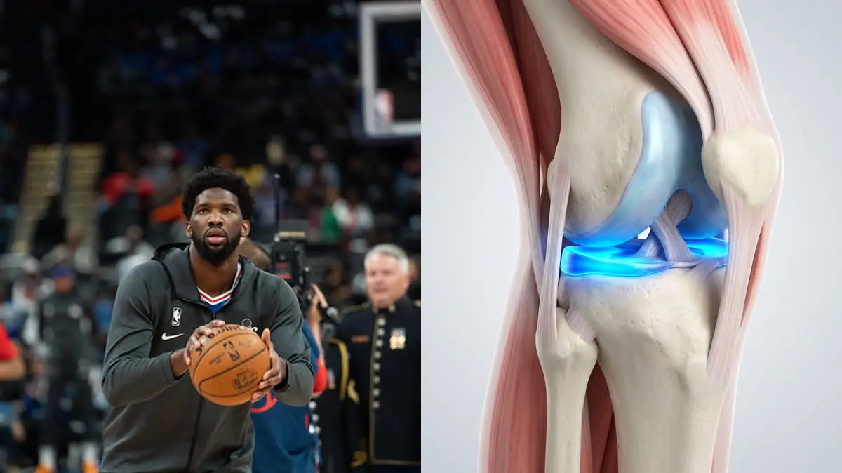 Joel Embiid's Meniscus Tear & Knee Biomechanics: Restoring Joint Stability