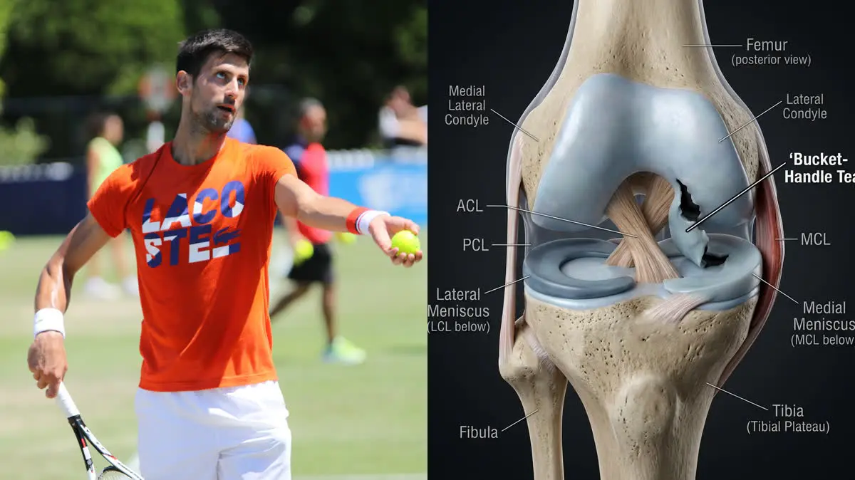 Novak Djokovic's French Open Meniscus Tear: Pathophysiology of Twisting Knee Injuries and Post-Operative Joint Preservation